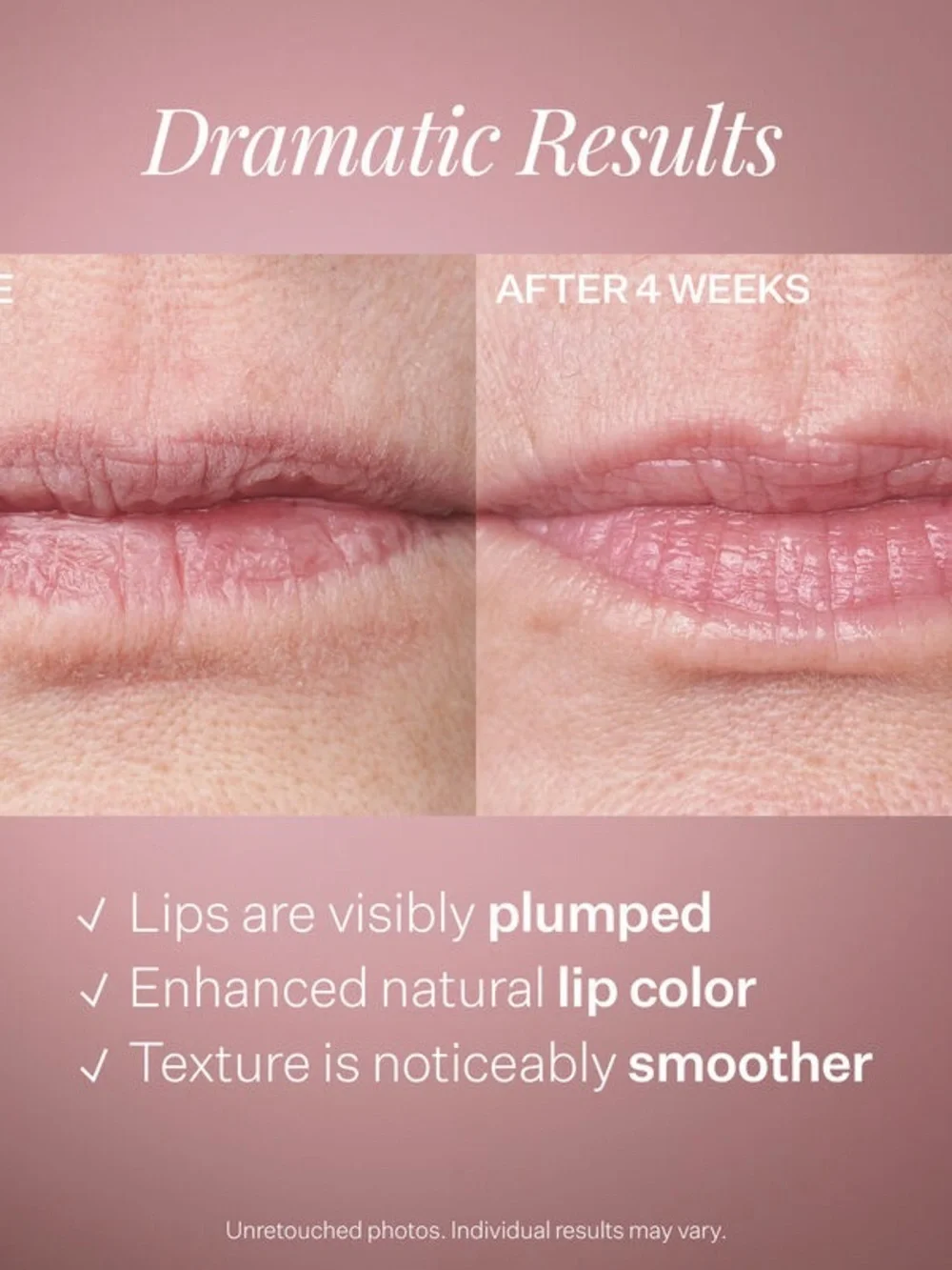 StriVectin Double-LX Plumping Lip Treatment - Deep Berry Pink